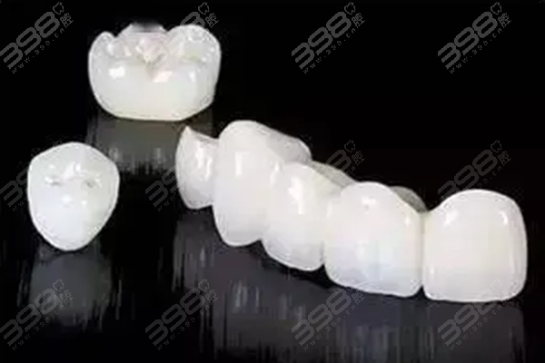 好的烤瓷牙价格